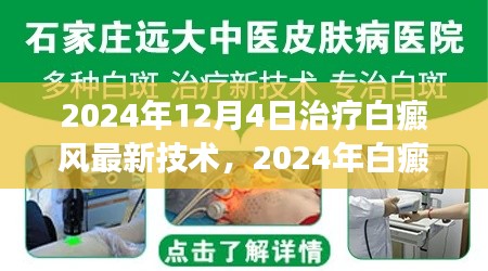 2024年白癜風(fēng)治療最新技術(shù)解讀與應(yīng)用前景展望，革新與未來(lái)趨勢(shì)